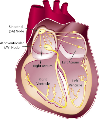 Normally, electrical impulses travel via specialized conduction pathways from the sinoatrial node to the atrioventricular node and then throughout the heart, in an orderly fashion. In MMD1, these conduction pathways are disrupted by scar tissue, leading to heart rhythm abnormalities. Less often, people with MMD1 develop problems that affect the heart’s pumping mechanism, a condition known as cardiomyopathy.