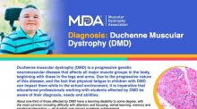 Downloadable educational flyer on Duchenne Muscular Dystrophy.