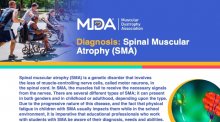 Downloadable educational flyer on Spinal Muscular Atrophy.
